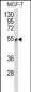 PDK3 Antibody